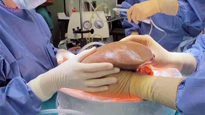 Pandemia prejudica transplante de Ã³rgÃ£os no Brasil