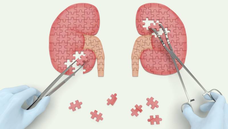 ApÃ³s 10 anos, Central Estadual avalia pacientes para transplante renal