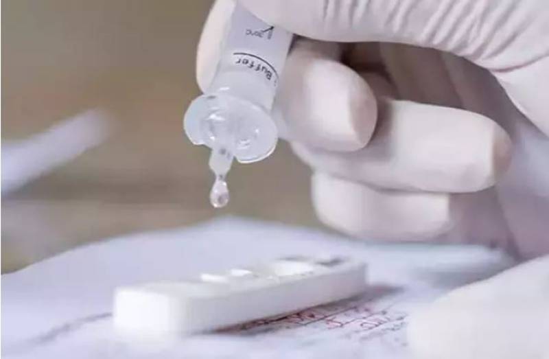 Anvisa deve liberar uso de autoteste de Covid no Brasil na sexta