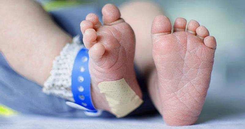 Hospitais podem ser obrigados a fazer teste de cariÃ³tipo em recÃ©m-nascidos