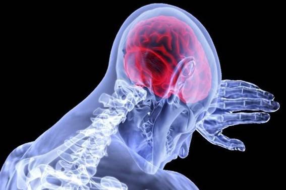 Monkeypox pode ser gatilho para convulsÃµes, apontam cientistas