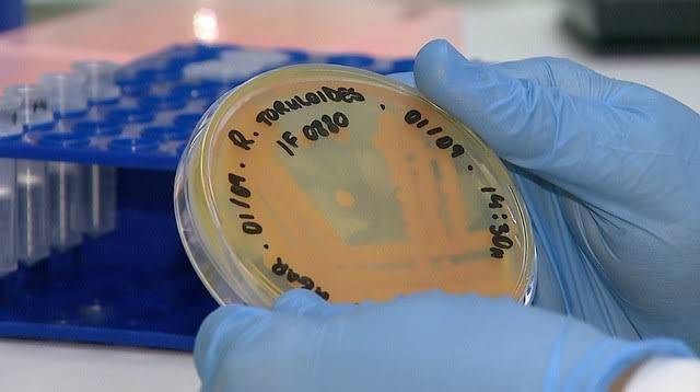  ARTIGO - BactÃ©rias resistentes Ã  limpeza sÃ£o fontes de contaminaÃ§Ã£o em UTIs