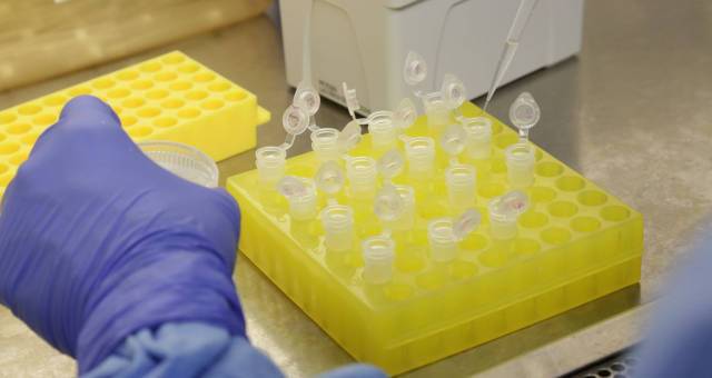 Cientistas identificam proteÃ­na que transporta o novo coronavÃ­rus