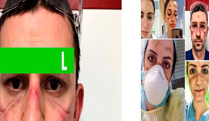 CoronavÃ­rus: MÃ©dicos fazem selfie para mostrar dias combatendo o vÃ­rus