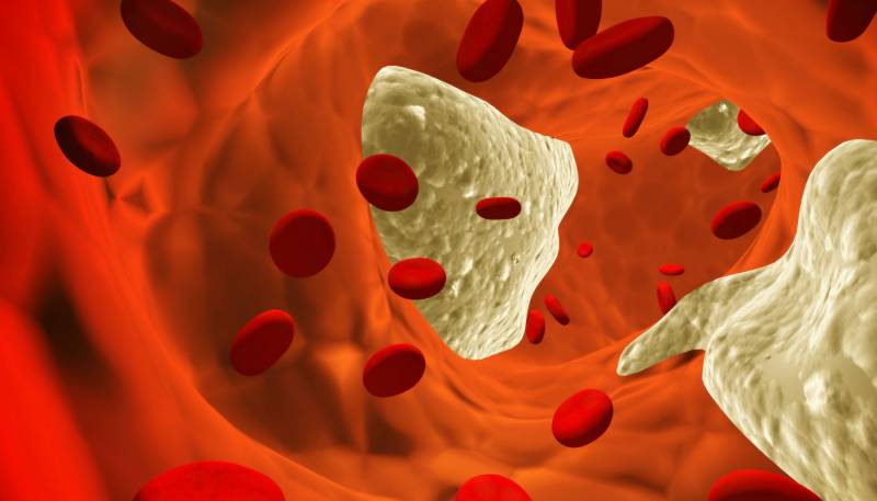COVID-19: CARDIOLOGISTAS APRESENTAM ESTUDO E ALERTAM SOBRE ATEROTROMBOSE E INFECÃÃES VIRAIS